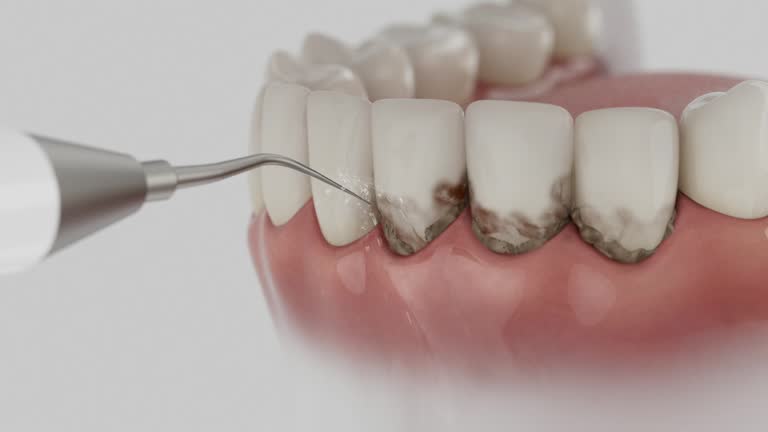 Trusted Teeth Cleaning And Checkup service in Dora, AL - Dentist Open Now